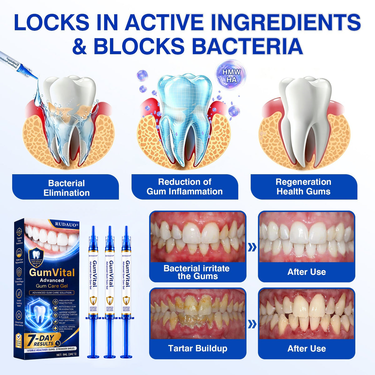 ๐ก๐๐๐๐๐ยฎ๐ฆท GumVital Advanced Gum Care Gel + ๐ FREE Gum Care Kit