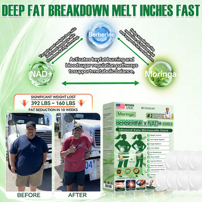 𝐎𝐟𝐟𝐢𝐜𝐢𝐚𝐥 𝐔𝐒 𝐒𝐭𝐨𝐫𝐞 | 🇺🇸 𝐑𝐔𝐃𝑨𝑼𝑶® Moringa · Berberine × NAD+ 𝟏𝟎-𝐢𝐧-𝟏 𝐀𝐝𝐯𝐚𝐧𝐜𝐞𝐝 𝐍𝐚𝐧𝐨 𝐌𝐢𝐜𝐫𝐨𝐧𝐞𝐞𝐝𝐥𝐞 𝐏𝐚𝐭𝐜𝐡 — 𝐎𝐧𝐜𝐞 𝐃𝐚𝐢𝐥𝐲, 𝐕𝐢𝐬𝐢𝐛𝐥𝐞 𝐑𝐞𝐬𝐮𝐥𝐭𝐬 𝐢𝐧 𝟕 𝐃𝐚𝐲𝐬