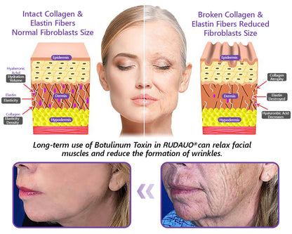 𝓡𝐔𝓓𝐀𝐔𝐎® ❄𝐏D𝐑N 𝐌u𝐥t𝐢-P𝐞p𝐭i𝐝e 𝐅i𝐫m𝐢n𝐠 𝐁o𝐝y 𝐓r𝐞a𝐭m𝐞n𝐭 - 𝐀n𝐭i-𝐀g𝐢n𝐠, 𝐇y𝐝r𝐚t𝐢n𝐠, 𝐒k𝐢n 𝐅i𝐫m𝐢n𝐠 & 𝐋i𝐟t𝐢n𝐠, 𝐒k𝐢n 𝐑e𝐩a𝐢r, 𝐄v𝐞n 𝐓o𝐧e, 𝐀c𝐧e 𝐚n𝐝 𝐃a𝐫k 𝐒p𝐨t 𝐓r𝐞a𝐭m𝐞n𝐭, 𝐖a𝐫t 𝐚n𝐝 𝐌o𝐥e 𝐑e𝐦o𝐯a𝐥, 𝐚n𝐝 𝐏s𝐨r𝐢a𝐬i𝐬 𝐑e𝐥i𝐞f
