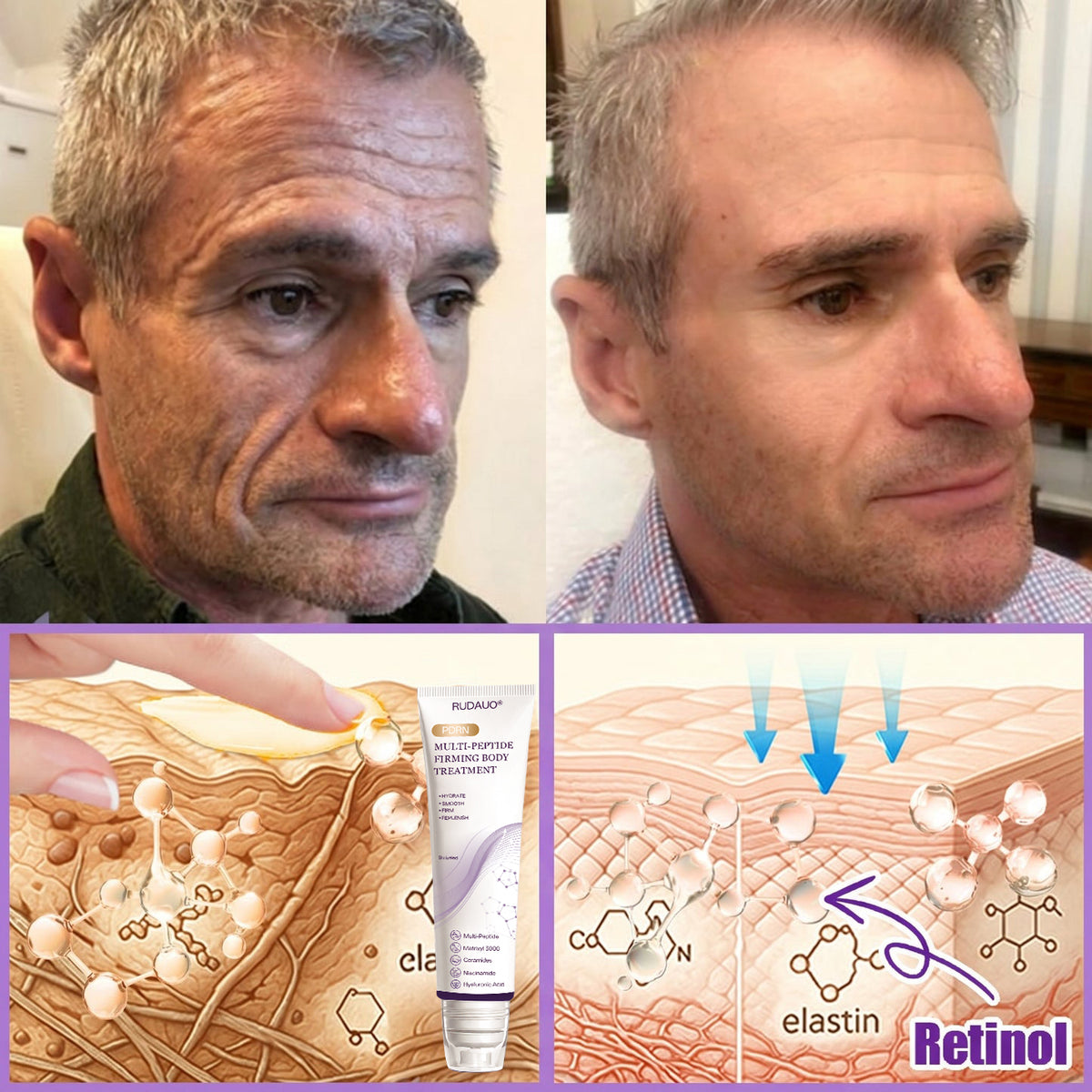 𝓡𝐔𝓓𝐀𝐔𝐎® ❀𝐏D𝐑N 𝐌u𝐥t𝐢-P𝐞p𝐭i𝐝e 𝐅i𝐫m𝐢n𝐠 𝐁o𝐝y 𝐓r𝐞a𝐭m𝐞n𝐭 - 𝐀n𝐭i-𝐀g𝐢n𝐠, 𝐇y𝐝r𝐚t𝐢n𝐠, 𝐒k𝐢n 𝐅i𝐫m𝐢n𝐠 & 𝐋i𝐟t𝐢n𝐠, 𝐒k𝐢n 𝐑e𝐩a𝐢r, 𝐄v𝐞n 𝐓o𝐧e, 𝐀c𝐧e 𝐚n𝐝 𝐃a𝐫k 𝐒p𝐨t 𝐓r𝐞a𝐭m𝐞n𝐭, 𝐖a𝐫t 𝐚n𝐝 𝐌o𝐥e 𝐑e𝐦o𝐯a𝐥, 𝐚n𝐝 𝐏s𝐨r𝐢a𝐬i𝐬 𝐑e𝐥i𝐞f