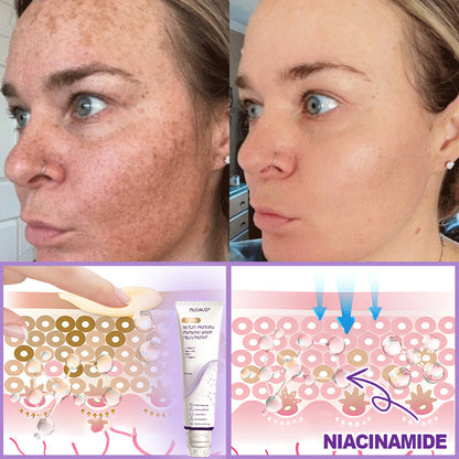 𝓡𝐔𝓓𝐀𝐔𝐎® ❀𝐏D𝐑N 𝐌u𝐥t𝐢-P𝐞p𝐭i𝐝e 𝐅i𝐫m𝐢n𝐠 𝐁o𝐝y 𝐓r𝐞a𝐭m𝐞n𝐭 - 𝐀n𝐭i-𝐀g𝐢n𝐠, 𝐇y𝐝r𝐚t𝐢n𝐠, 𝐒k𝐢n 𝐅i𝐫m𝐢n𝐠 & 𝐋i𝐟t𝐢n𝐠, 𝐒k𝐢n 𝐑e𝐩a𝐢r, 𝐄v𝐞n 𝐓o𝐧e, 𝐀c𝐧e 𝐚n𝐝 𝐃a𝐫k 𝐒p𝐨t 𝐓r𝐞a𝐭m𝐞n𝐭, 𝐖a𝐫t 𝐚n𝐝 𝐌o𝐥e 𝐑e𝐦o𝐯a𝐥, 𝐚n𝐝 𝐏s𝐨r𝐢a𝐬i𝐬 𝐑e𝐥i𝐞f