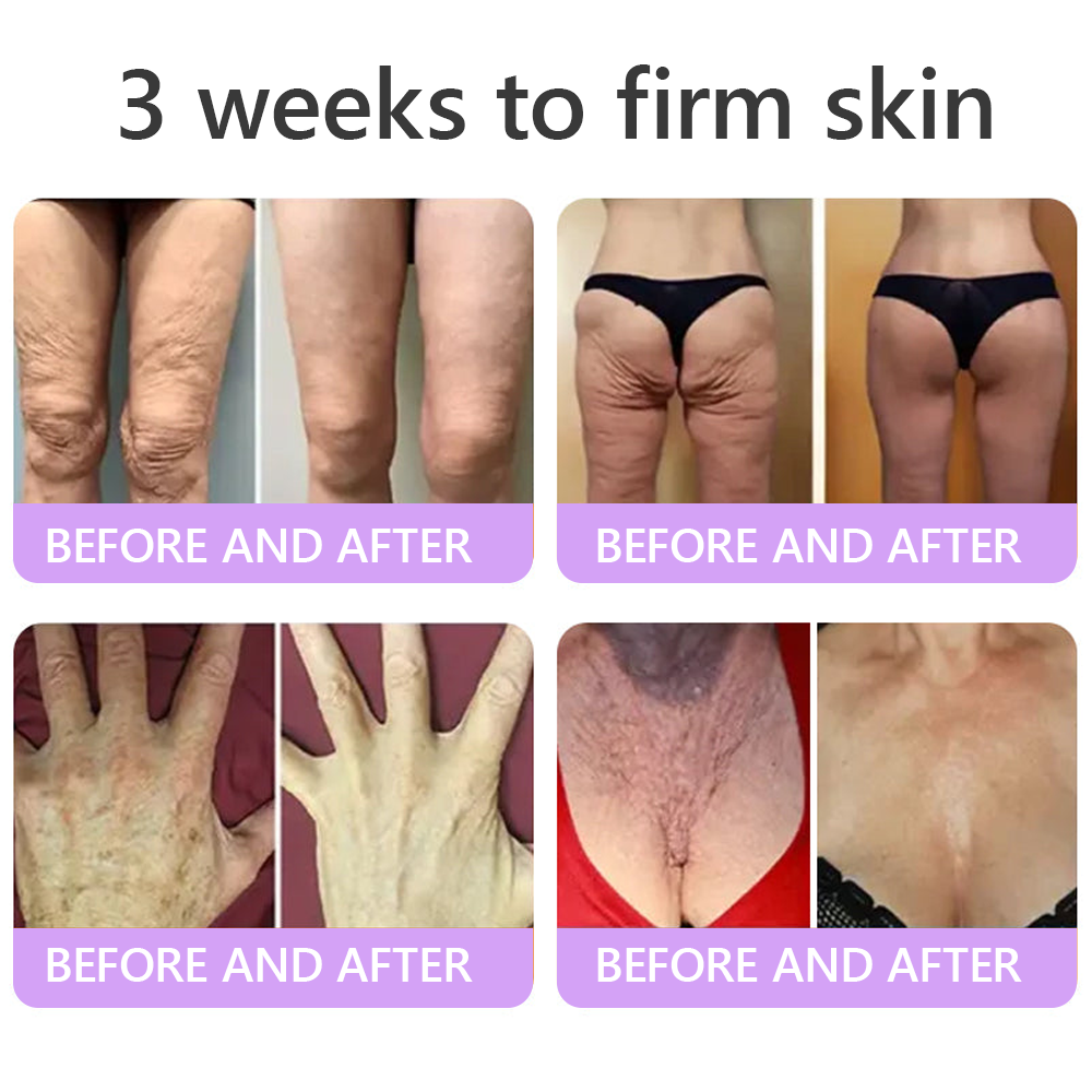 𝓡𝐔𝓓𝐀𝐔𝐎® ❀𝐏D𝐑N 𝐌u𝐥t𝐢-P𝐞p𝐭i𝐝e 𝐅i𝐫m𝐢n𝐠 𝐁o𝐝y 𝐓r𝐞a𝐭m𝐞n𝐭 - 𝐀n𝐭i-𝐀g𝐢n𝐠, 𝐇y𝐝r𝐚t𝐢n𝐠, 𝐒k𝐢n 𝐅i𝐫m𝐢n𝐠 & 𝐋i𝐟t𝐢n𝐠, 𝐒k𝐢n 𝐑e𝐩a𝐢r, 𝐄v𝐞n 𝐓o𝐧e, 𝐀c𝐧e 𝐚n𝐝 𝐃a𝐫k 𝐒p𝐨t 𝐓r𝐞a𝐭m𝐞n𝐭, 𝐖a𝐫t 𝐚n𝐝 𝐌o𝐥e 𝐑e𝐦o𝐯a𝐥, 𝐚n𝐝 𝐏s𝐨r𝐢a𝐬i𝐬 𝐑e𝐥i𝐞f