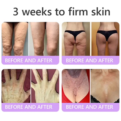 𝓡𝐔𝓓𝐀𝐔𝐎® ❀𝐏D𝐑N 𝐌u𝐥t𝐢-P𝐞p𝐭i𝐝e 𝐅i𝐫m𝐢n𝐠 𝐁o𝐝y 𝐓r𝐞a𝐭m𝐞n𝐭 - 𝐀n𝐭i-𝐀g𝐢n𝐠, 𝐇y𝐝r𝐚t𝐢n𝐠, 𝐒k𝐢n 𝐅i𝐫m𝐢n𝐠 & 𝐋i𝐟t𝐢n𝐠, 𝐒k𝐢n 𝐑e𝐩a𝐢r, 𝐄v𝐞n 𝐓o𝐧e, 𝐀c𝐧e 𝐚n𝐝 𝐃a𝐫k 𝐒p𝐨t 𝐓r𝐞a𝐭m𝐞n𝐭, 𝐖a𝐫t 𝐚n𝐝 𝐌o𝐥e 𝐑e𝐦o𝐯a𝐥, 𝐚n𝐝 𝐏s𝐨r𝐢a𝐬i𝐬 𝐑e𝐥i𝐞f