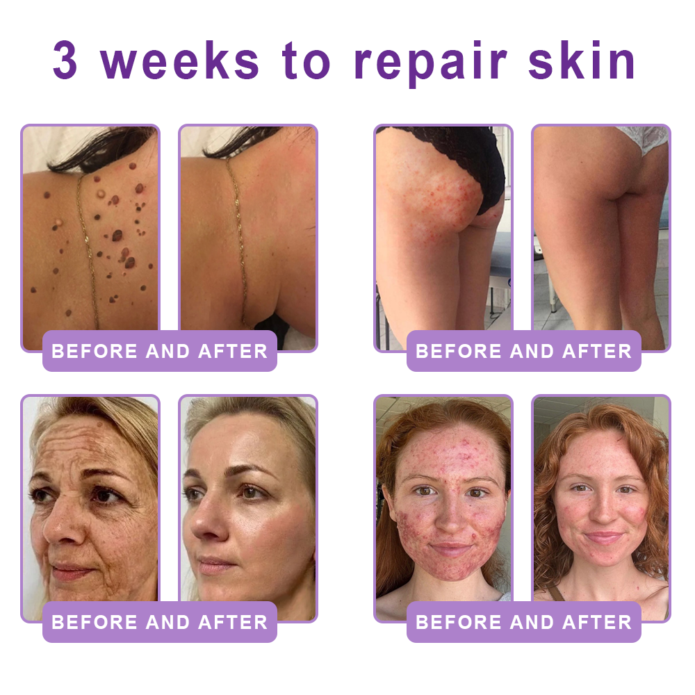 𝓡𝐔𝓓𝐀𝐔𝐎® ❀𝐏D𝐑N 𝐌u𝐥t𝐢-P𝐞p𝐭i𝐝e 𝐅i𝐫m𝐢n𝐠 𝐁o𝐝y 𝐓r𝐞a𝐭m𝐞n𝐭 - 𝐀n𝐭i-𝐀g𝐢n𝐠, 𝐇y𝐝r𝐚t𝐢n𝐠, 𝐒k𝐢n 𝐅i𝐫m𝐢n𝐠 & 𝐋i𝐟t𝐢n𝐠, 𝐒k𝐢n 𝐑e𝐩a𝐢r, 𝐄v𝐞n 𝐓o𝐧e, 𝐀c𝐧e 𝐚n𝐝 𝐃a𝐫k 𝐒p𝐨t 𝐓r𝐞a𝐭m𝐞n𝐭, 𝐖a𝐫t 𝐚n𝐝 𝐌o𝐥e 𝐑e𝐦o𝐯a𝐥, 𝐚n𝐝 𝐏s𝐨r𝐢a𝐬i𝐬 𝐑e𝐥i𝐞f
