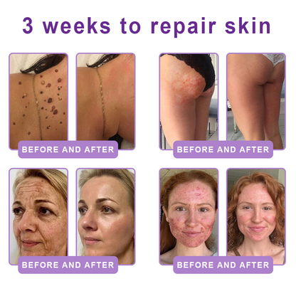 𝓡𝐔𝓓𝐀𝐔𝐎® ❀𝐏D𝐑N 𝐌u𝐥t𝐢-P𝐞p𝐭i𝐝e 𝐅i𝐫m𝐢n𝐠 𝐁o𝐝y 𝐓r𝐞a𝐭m𝐞n𝐭 - 𝐀n𝐭i-𝐀g𝐢n𝐠, 𝐇y𝐝r𝐚t𝐢n𝐠, 𝐒k𝐢n 𝐅i𝐫m𝐢n𝐠 & 𝐋i𝐟t𝐢n𝐠, 𝐒k𝐢n 𝐑e𝐩a𝐢r, 𝐄v𝐞n 𝐓o𝐧e, 𝐀c𝐧e 𝐚n𝐝 𝐃a𝐫k 𝐒p𝐨t 𝐓r𝐞a𝐭m𝐞n𝐭, 𝐖a𝐫t 𝐚n𝐝 𝐌o𝐥e 𝐑e𝐦o𝐯a𝐥, 𝐚n𝐝 𝐏s𝐨r𝐢a𝐬i𝐬 𝐑e𝐥i𝐞f