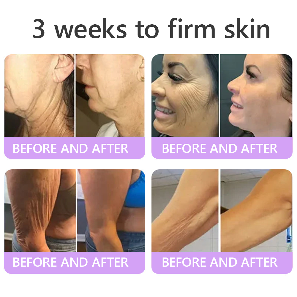 𝓡𝐔𝓓𝐀𝐔𝐎® ❀𝐏D𝐑N 𝐌u𝐥t𝐢-P𝐞p𝐭i𝐝e 𝐅i𝐫m𝐢n𝐠 𝐁o𝐝y 𝐓r𝐞a𝐭m𝐞n𝐭 - 𝐀n𝐭i-𝐀g𝐢n𝐠, 𝐇y𝐝r𝐚t𝐢n𝐠, 𝐒k𝐢n 𝐅i𝐫m𝐢n𝐠 & 𝐋i𝐟t𝐢n𝐠, 𝐒k𝐢n 𝐑e𝐩a𝐢r, 𝐄v𝐞n 𝐓o𝐧e, 𝐀c𝐧e 𝐚n𝐝 𝐃a𝐫k 𝐒p𝐨t 𝐓r𝐞a𝐭m𝐞n𝐭, 𝐖a𝐫t 𝐚n𝐝 𝐌o𝐥e 𝐑e𝐦o𝐯a𝐥, 𝐚n𝐝 𝐏s𝐨r𝐢a𝐬i𝐬 𝐑e𝐥i𝐞f